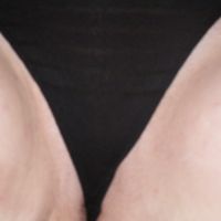 frei blasen thumb